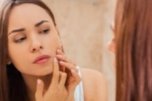Ayuda prevenir el acné con una rutina de cuidado de la piel adecuada